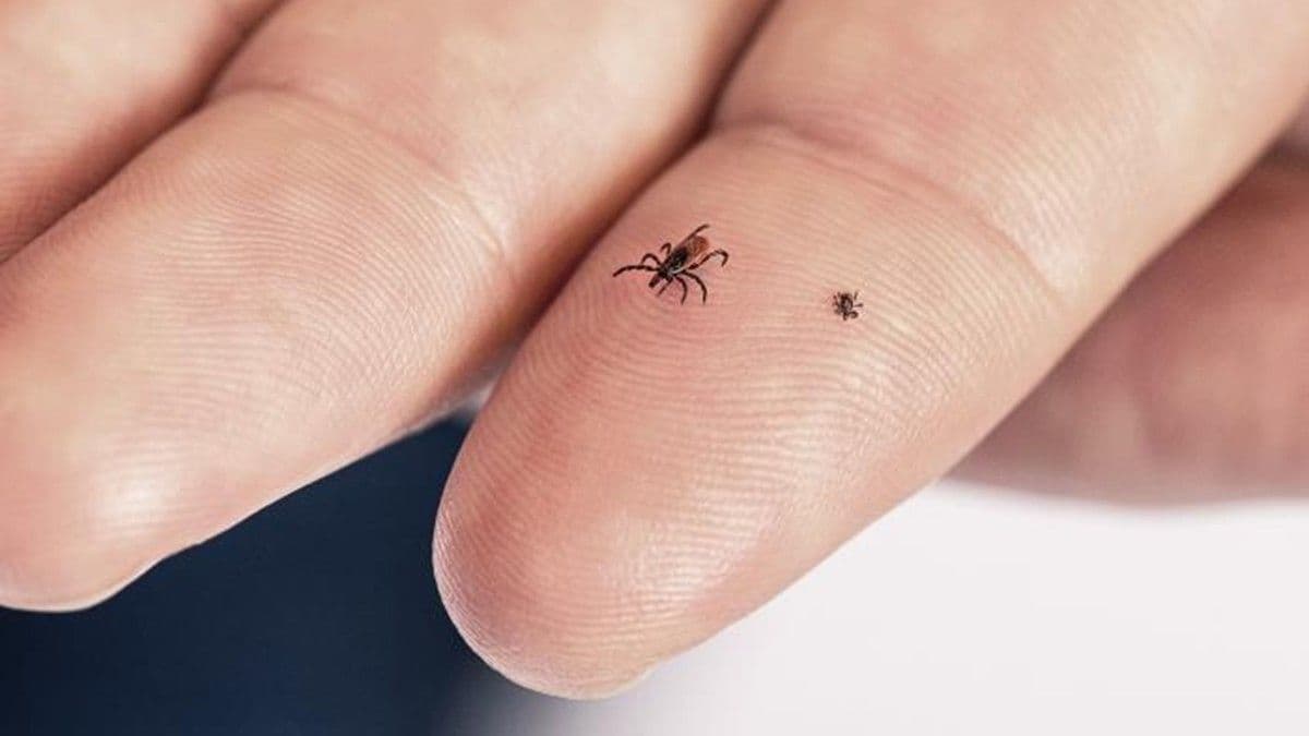 Tick Bites